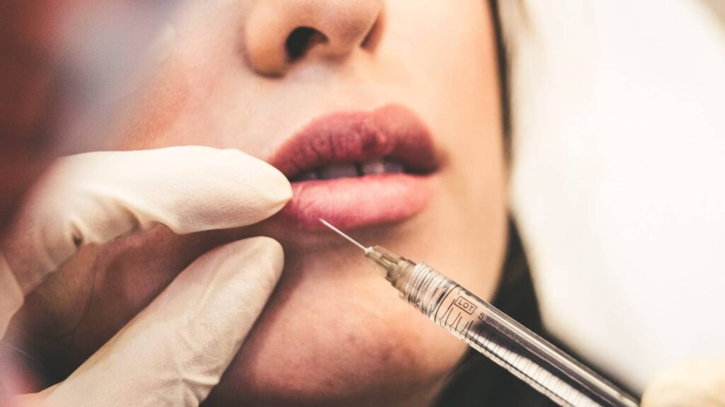 Auckland women's five-month battle to reclaim face fillers