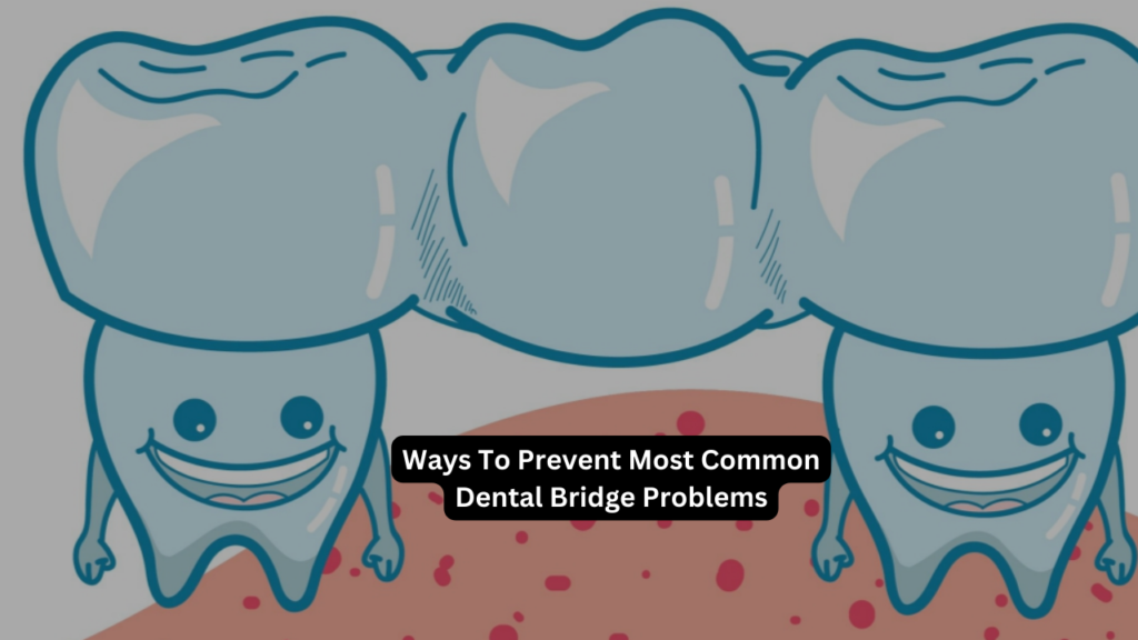 Prevent Dental Bridge Problems Featured Img