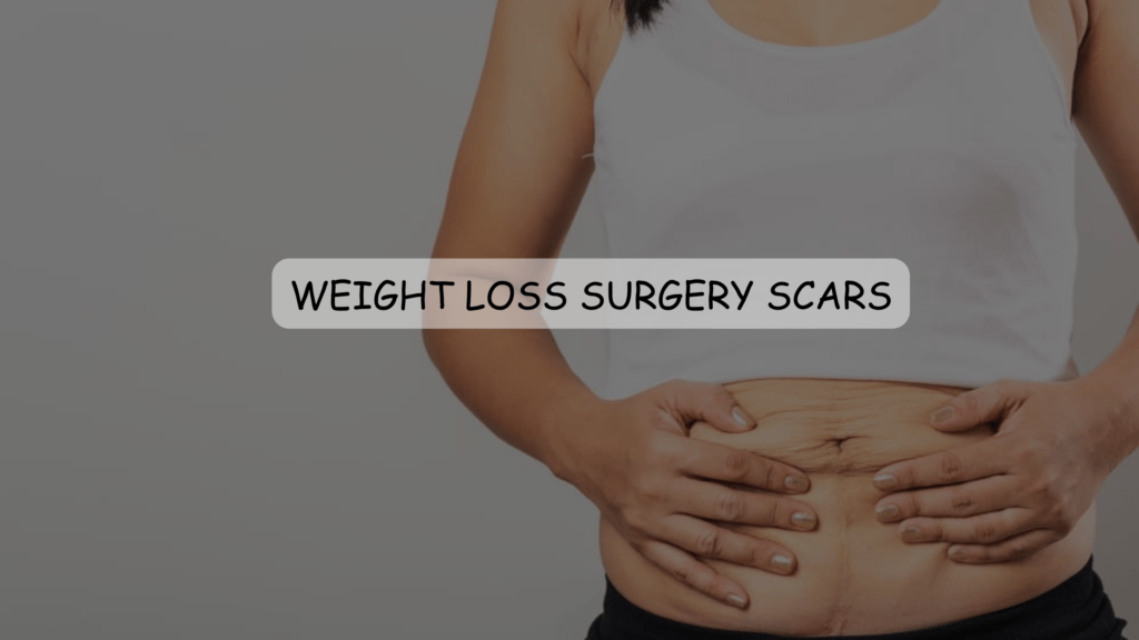 Decoding Weight Loss Surgery Scars-Types and Care Featured Images